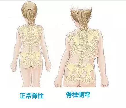 久坐會造成脊柱問題，影響兒童成長