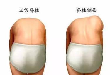 寶寶身高原來與脊椎發(fā)育有關,有些動作要注意！