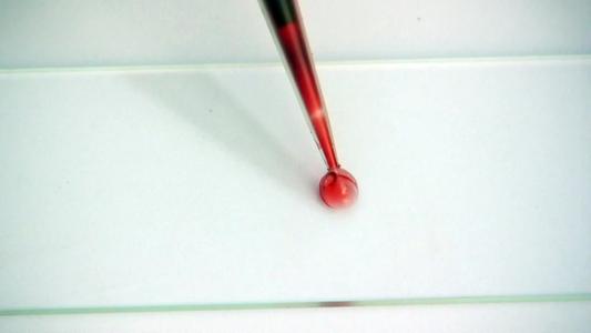 滴血可驗(yàn)！鐘南山團(tuán)隊(duì)研發(fā)快速便捷檢測(cè)試劑