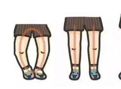 寶寶走路“八字腳”？或是因?yàn)榧议L做錯(cuò)了這些事！