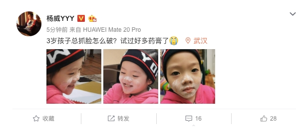 3歲女兒總愛(ài)抓破臉涂藥膏無(wú)果 楊威無(wú)奈發(fā)文求助