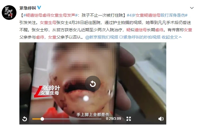 4歲女童疑遭繼母毆打重傷進(jìn)ICU：虐童案頻發(fā)，除了憤怒我們更應(yīng)該站出來(lái)