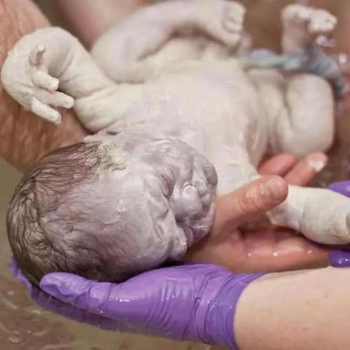 寶寶剛出生時身上一層白白的是什么？需要清理嗎？