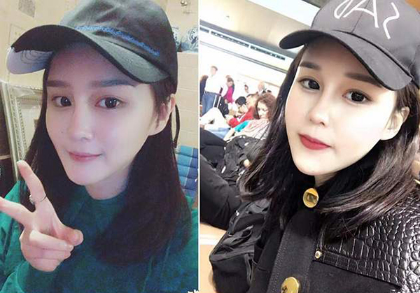 趙本山女兒撞臉李小璐？竟花30萬(wàn)做鼻子！