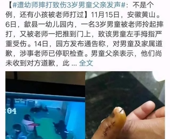 得知孩子被虐待，寶爸怒打幼師，園方袒護(hù)老師不道歉不讓報(bào)警
