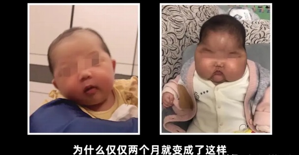 “大頭娃娃”重現(xiàn)，原因竟然是嬰兒霜激素超標(biāo)