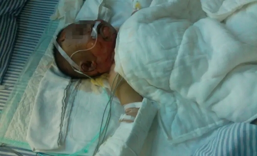 眼見孫女掉進熱水鍋，奶奶卻還抱著孫子不撒手，重男輕女害人不淺