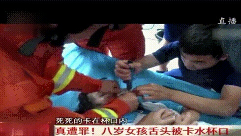 來自喝水杯的惡意，8歲女孩舌頭被水杯口卡住，險被夾斷
