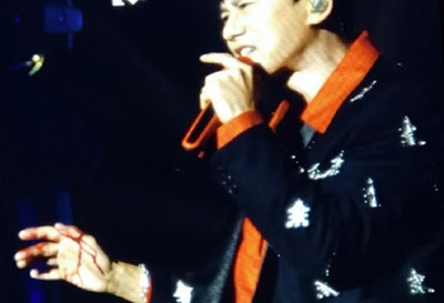 張杰舞臺事故受傷，去醫(yī)院前還在關(guān)心是否嚇到了孩子