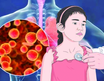 肺炎支原體感染高發(fā)，孩子中招要避免重癥發(fā)生