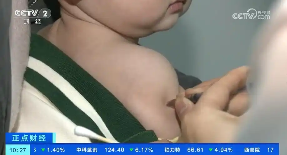 春季手足口病易感 疾控中心提醒5歲以下兒童要做好健康監(jiān)測