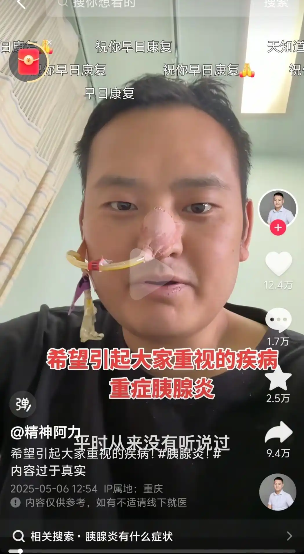 放縱飲食，須警惕“重癥急性胰腺炎”這個健康殺手